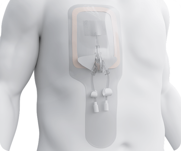 Dialtec™ Waterproof Protection Pouch